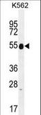 Keratin 25 antibody, LS-C165620, Lifespan Biosciences, Western Blot image 