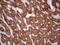 4-Aminobutyrate Aminotransferase antibody, LS-C340145, Lifespan Biosciences, Immunohistochemistry paraffin image 