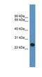 BCL2 Interacting Protein 1 antibody, NBP1-69183, Novus Biologicals, Western Blot image 