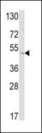 Endothelin B receptor antibody, GTX17408, GeneTex, Western Blot image 