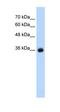 Gamma-Aminobutyric Acid Type A Receptor Gamma2 Subunit antibody, orb329838, Biorbyt, Western Blot image 