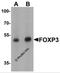 FOXP3 antibody, 7187, ProSci, Western Blot image 