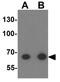 Tektin-5 antibody, GTX31443, GeneTex, Western Blot image 
