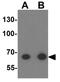 Tektin 5 antibody, GTX31443, GeneTex, Western Blot image 