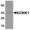 Potassium Two Pore Domain Channel Subfamily K Member 1 antibody, TA349116, Origene, Western Blot image 