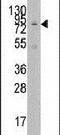 Lysine Acetyltransferase 2A antibody, PA5-11213, Invitrogen Antibodies, Western Blot image 