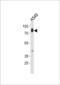 HCK Proto-Oncogene, Src Family Tyrosine Kinase antibody, LS-C166814, Lifespan Biosciences, Western Blot image 