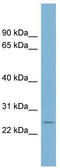 CD160 Molecule antibody, TA346450, Origene, Western Blot image 