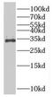 ADP/ATP translocase 3 antibody, FNab07946, FineTest, Western Blot image 