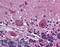 Platelet Derived Growth Factor Receptor Alpha antibody, LS-B6056, Lifespan Biosciences, Immunohistochemistry frozen image 