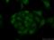 Casein Kinase 2 Alpha 1 antibody, 10606-1-AP, Proteintech Group, Immunofluorescence image 