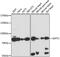 Glutamine-Fructose-6-Phosphate Transaminase 2 antibody, GTX66370, GeneTex, Western Blot image 