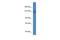 Cell Migration Inducing Hyaluronidase 2 antibody, A09886, Boster Biological Technology, Western Blot image 