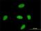Yes Associated Protein 1 antibody, H00010413-M02, Novus Biologicals, Immunofluorescence image 