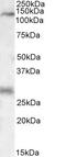 Mitogen-Activated Protein Kinase Kinase Kinase 6 antibody, EB09554, Everest Biotech, Western Blot image 