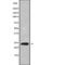 C-Type Lectin Domain Containing 6A antibody, abx149391, Abbexa, Western Blot image 