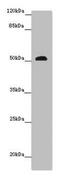 Serine Carboxypeptidase 1 antibody, CSB-PA867189LA01HU, Cusabio, Western Blot image 