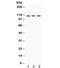 Unc-5 Netrin Receptor C antibody, R31843, NSJ Bioreagents, Western Blot image 