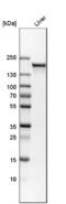 Carbamoyl-Phosphate Synthase 1 antibody, NBP1-86019, Novus Biologicals, Western Blot image 