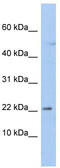 Chromosome 19 Open Reading Frame 25 antibody, TA335385, Origene, Western Blot image 