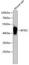Beaded Filament Structural Protein 2 antibody, 14-769, ProSci, Western Blot image 