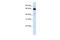 Solute Carrier Family 39 Member 4 antibody, PA5-69274, Invitrogen Antibodies, Western Blot image 