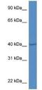 PR/SET Domain 12 antibody, NBP1-79697, Novus Biologicals, Western Blot image 