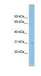 Spermatogenesis Associated 9 antibody, NBP1-59840, Novus Biologicals, Western Blot image 