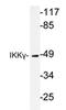 Inhibitor Of Nuclear Factor Kappa B Kinase Regulatory Subunit Gamma antibody, AP20347PU-N, Origene, Western Blot image 