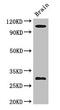 EPH Receptor A1 antibody, orb45830, Biorbyt, Western Blot image 