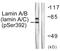 Lamin A/C antibody, LS-C199188, Lifespan Biosciences, Western Blot image 