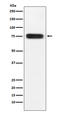 CD97 antigen antibody, M02982, Boster Biological Technology, Western Blot image 