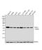 Superoxide Dismutase 2 antibody, GTX31147, GeneTex, Western Blot image 