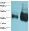 Alpha/beta-gliadin antibody, LS-C212228, Lifespan Biosciences, Western Blot image 