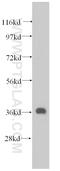 Mitochondrial Trans-2-Enoyl-CoA Reductase antibody, 14932-1-AP, Proteintech Group, Western Blot image 