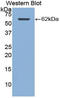 Cathepsin A antibody, LS-C303098, Lifespan Biosciences, Western Blot image 