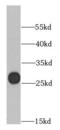 General Transcription Factor IIF Subunit 2 antibody, FNab03710, FineTest, Western Blot image 