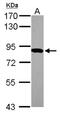 HPS6 Biogenesis Of Lysosomal Organelles Complex 2 Subunit 3 antibody, NBP2-16877, Novus Biologicals, Western Blot image 