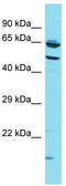 Vacuolar fusion protein CCZ1 homolog B antibody, TA334820, Origene, Western Blot image 