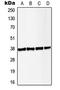 Linker For Activation Of T Cells antibody, LS-C353411, Lifespan Biosciences, Western Blot image 