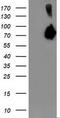 Asparagine Synthetase (Glutamine-Hydrolyzing) antibody, TA503452, Origene, Western Blot image 