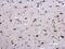 EWS RNA Binding Protein 1 antibody, PA5-29905, Invitrogen Antibodies, Immunohistochemistry paraffin image 