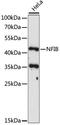 Nuclear Factor I B antibody, LS-C750263, Lifespan Biosciences, Western Blot image 