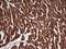Troponin I1, Slow Skeletal Type antibody, NBP2-46170, Novus Biologicals, Immunohistochemistry frozen image 
