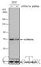 ATPase H+ Transporting V1 Subunit A antibody, GTX633544, GeneTex, Western Blot image 