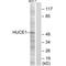 Ribosomal RNA Processing 8 antibody, A09950, Boster Biological Technology, Western Blot image 