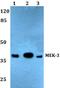 Mitogen-Activated Protein Kinase Kinase 3 antibody, A02916S183, Boster Biological Technology, Western Blot image 