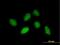 Rhox Homeobox Family Member 1 antibody, H00158800-B01P, Novus Biologicals, Immunocytochemistry image 