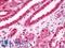 Myocardin Related Transcription Factor A antibody, LS-B11058, Lifespan Biosciences, Immunohistochemistry frozen image 