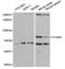 Forkhead Box M1 antibody, LS-C332114, Lifespan Biosciences, Western Blot image 
